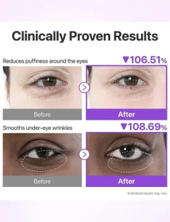 No.9 NAD Under Eye Patches - Ögonmask|Numbuzin Hot